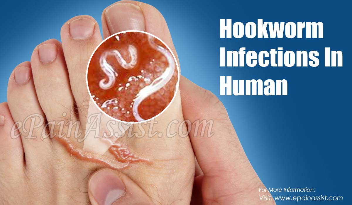 what causes hookworms in humans